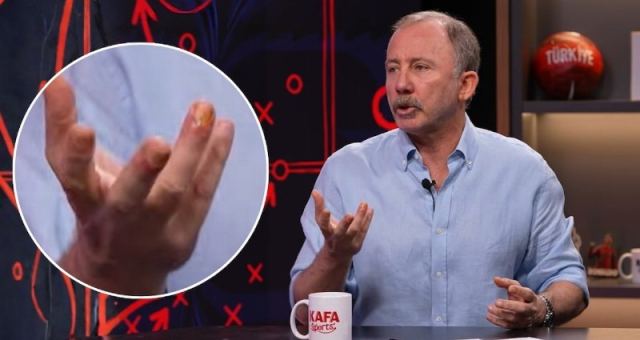 Sergen Yalçın'ın Parmaklarındaki Sır Ne?