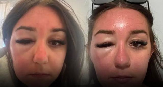 Yunanistan Tatilinde Şaşırtan Sağlık Krizi: Enfeksiyon Kabusu