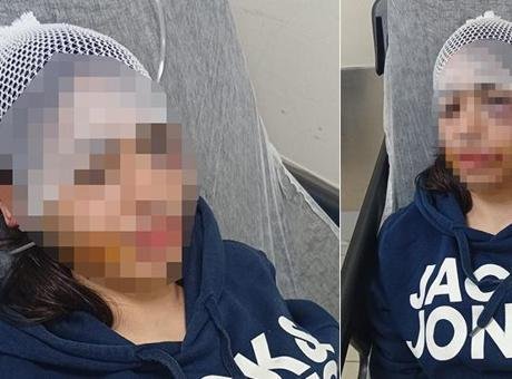 Ayrılık Kararı Sonrası Yaşanan Dehşet: Kadın Darp Edildi