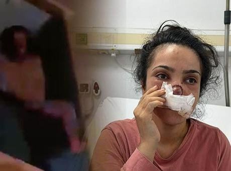 Dehşet Anları: Eşinin Burnunu Koparan Adam Tutuklandı