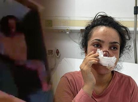 Dehşet Anları: Eşinin Burnunu Koparan Adam Tutuklandı