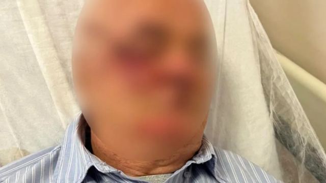 Kartal'da Emekli Başkomisere Çocuk Uyarısı Sonrası Darp