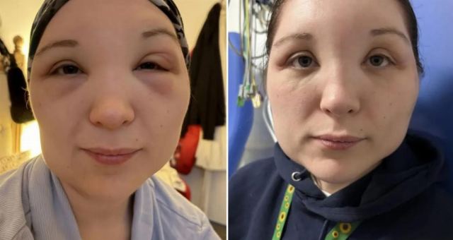 İsabella Martin'in Saç Boyama Deneyimi Hastaneye Taşındı