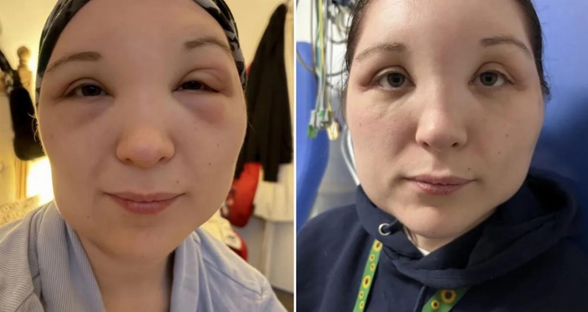 İsabella Martin'in Saç Boyama Deneyimi Hastaneye Taşındı