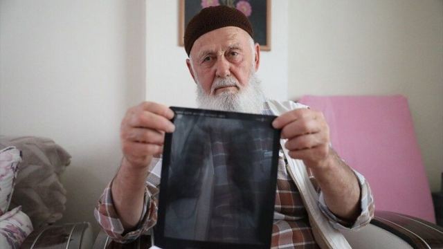 Osman Gülay, sigara yüzünden parmaklarını kaybettiğini anlattı