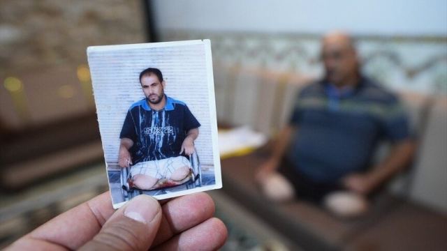 Irak'ta ABD işgali sonrası siviller uzuvlarını kaybetti