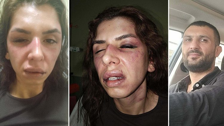 İstanbul'da Eşine Şiddet Uygulayan Kocaya 11,5 Yıl Hapis İstemi