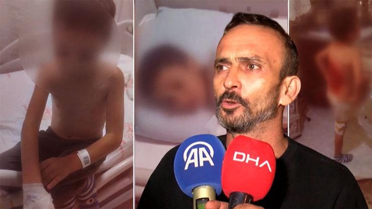 Arnavutköy'de çocuk, arkadaşları tarafından yakıldı