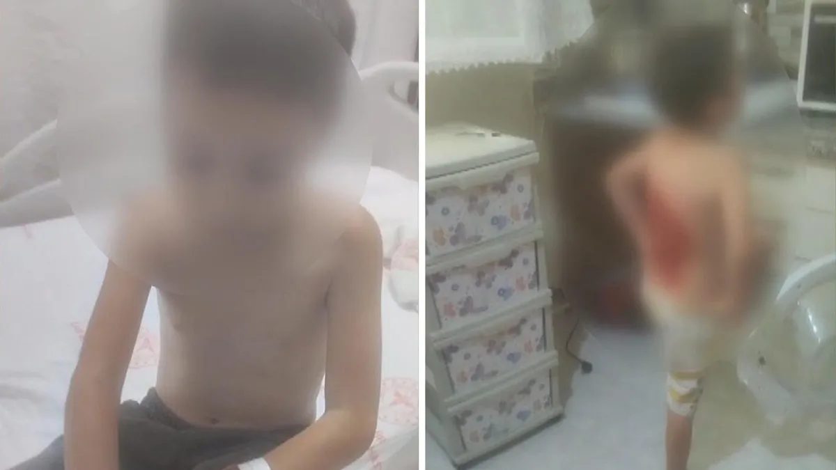 Arnavutköy'de çocuk arkadaşları üzerine kolonya döküp yaktı