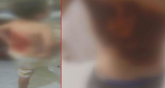 Arnavutköy'de 12 yaşındaki çocuğa kolonyalı saldırı